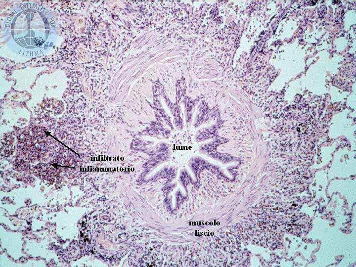 Principali caratteristiche anatomo-patologiche