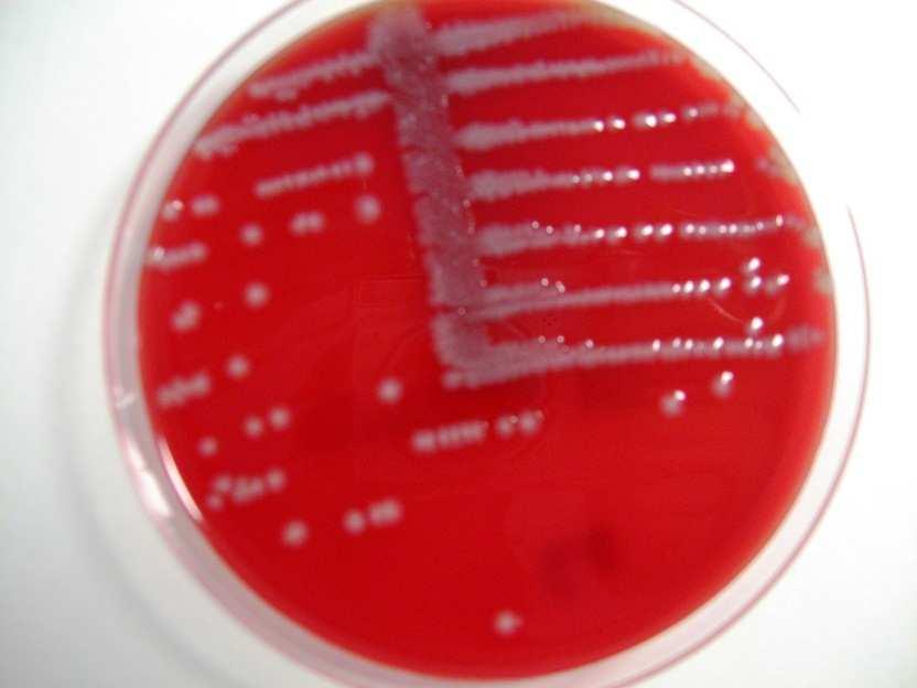 Il gold standard per la diagnosi delle UVI è un esame