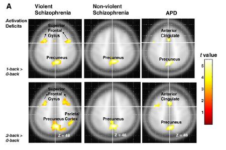 Neural dysfunction and violence in schizophrenia: An fmri investigation. Kumari et al.
