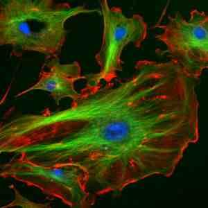 recentemente è stato anche identificato in cellule procariote.