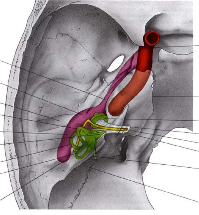 Tuba uditiva Recesso epitimpanico Meato acustico esterno CSA Aditus ad antrum Vestibolo CSL CSP A. carotide interna Solco del seno petroso inferiore Coclea N.