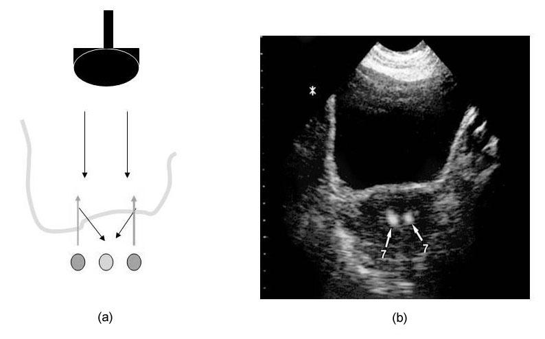 tessuti: schema (a) e relativa immagine ecografica (b) 6 Schema (a) e immagine (b) ottenuta insonando