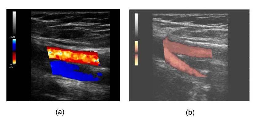 volume campione di cui si elabora il sonogramma (c) (cortesia dr. G.F.