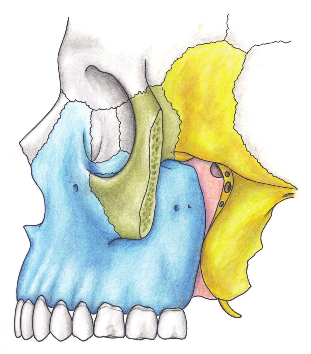 CAPITOLO 1 Anatomia sistematica del distretto craniofacciale Approfondimento anatomico Seguito PALATINO SFENOIDE Grande ala dello sfenoide sfenopalatino Canale