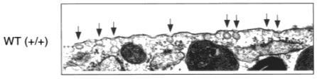 -Involved in: endocytosis lipid recycling signaling: