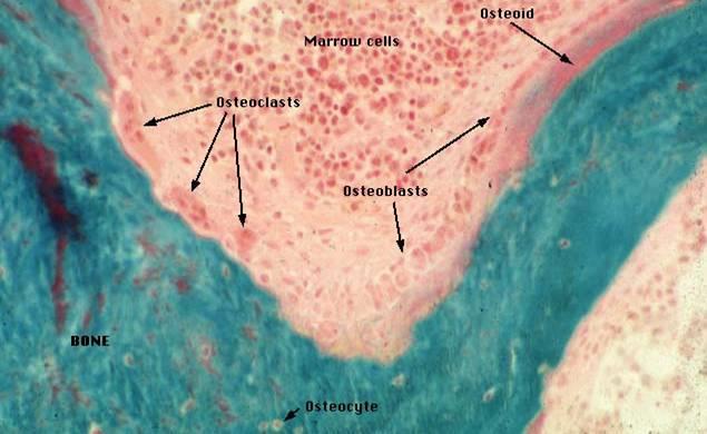 Formazione dell osso: OSTEOBLASTI sintetizzano e depositano collageno Le fibre di collageno si allineano in maniera regolare, producendo una matrice organica (OSTEOIDE), all interno della quale