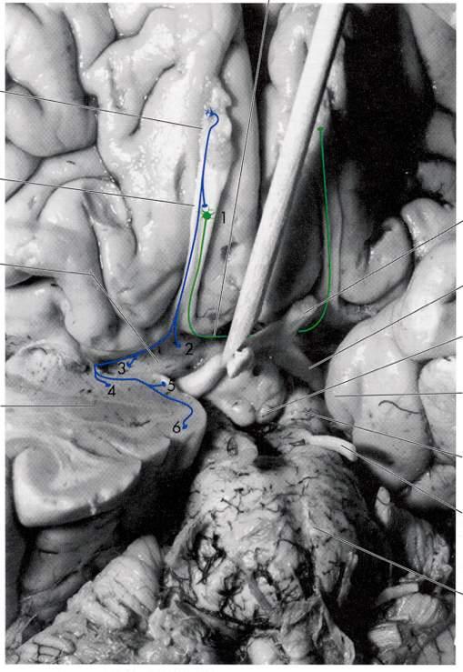 Commessura anteriore Immagine tratta da: The Human Brain, J. Nolte, Mosby V Edizione 2002 Bulbo olfattivo Tratto olfattivo Sostanza perforata anteriore Amigdala 1 Nucleo olfattivo anteriore!