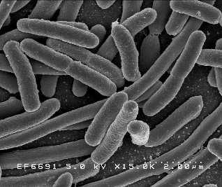 Escherichia coli Campylobacter spp.