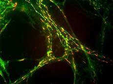 Membrane mitocondriali JC 1 Fig. 1. Cultured human bronchial smooth muscle cell stained with mitochondrial membrane potential indicator JC-1.