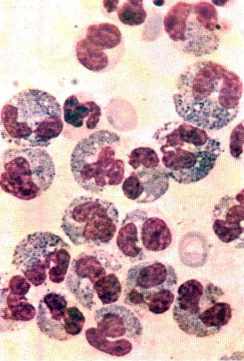 Midollo osseo Si noti un isolotto di metamielociti e