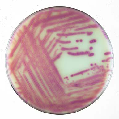 ESBL : coltura mista di Klebsiella pneumoniae (colonie blu) ed Escherichia coli (colonie rosa) produttori di ESBL CRE : Klebsiella pneumoniae resistente ai USO PREVISTO Terreno di base e supplementi