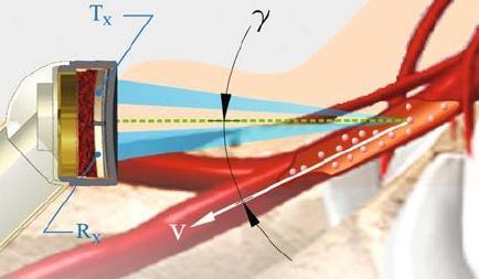 Ecotomografia Eco doppler La funzione doppler risponde alla necessità di rappresentare informazioni sulla dinamica del sangue nei vasi in tempo reale.