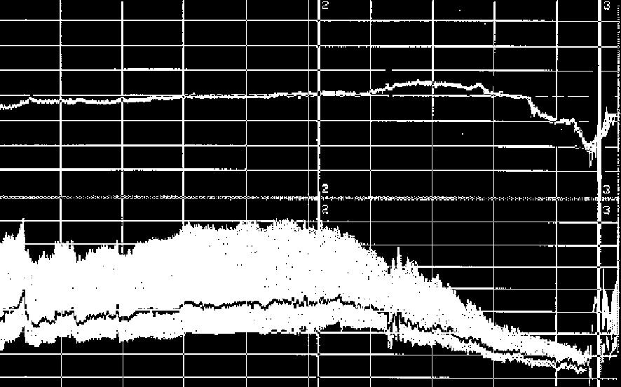 Dysautonomic vasovagal syncope pattern Pre-syncopal phase Syncopal