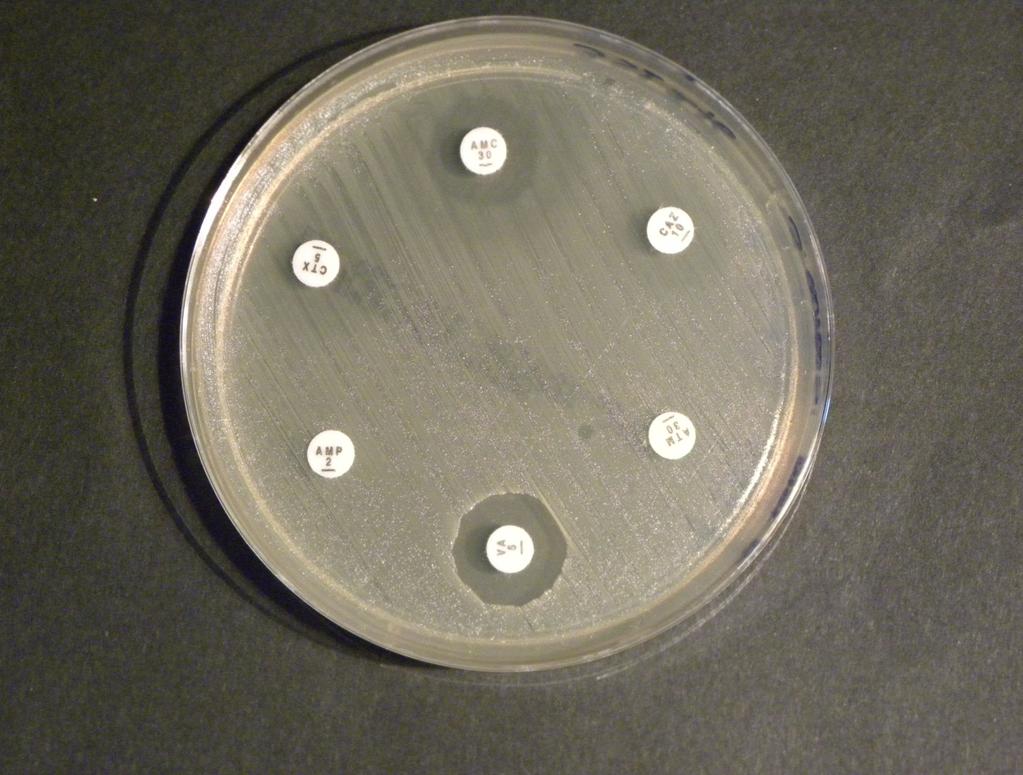 Antibiogramma diretto: Staphylococcus