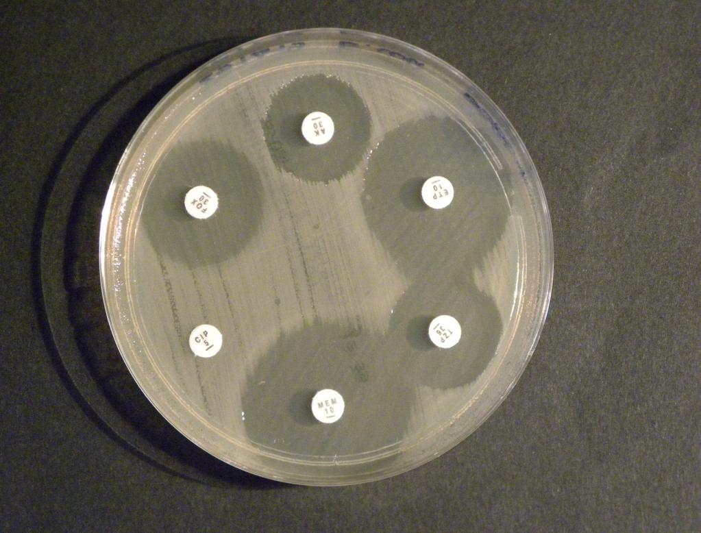 Antibiogramma diretto: Escherichia