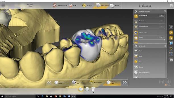 11 12 Corso di abilitazione Cod. Mod. 001 LAB Corso di abilitazione Cod. Mod. 002 LAB La metodica Dentsply Sirona inlab nelle riabilitazioni metalfree in protesi fissa - Step 1 Trainer tecnici Dentsply Sirona Academy 10 2 giorni 9.