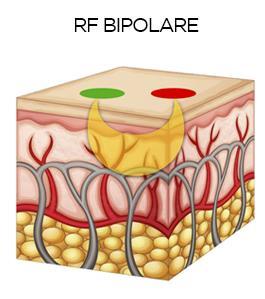 RADIOFREQUENZA La radiofrequenza genera un segnale elettrico o un'onda elettromagnetica ad alta frequenza che si propaga nello spazio.