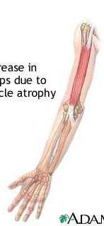 TOSSICITA COMPLICANZE POST-OPERATORIE