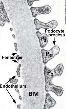 La barriera di filtrazione del glomerulo è formata da: Lo strato di podociti della capsula di Bowman L endotelio fenestrato del glomerulo Una spessa membrana basale carica negativamente condivisa fra
