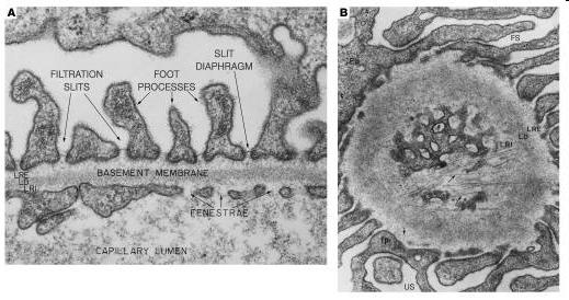 htm Electron micrographs showing a peripheral region of a glomerular capillary where filtration takes place.