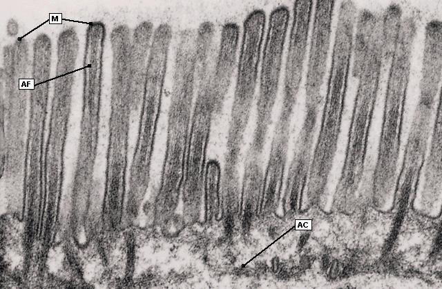 luminale degli epiteli colonnari di assorbimento