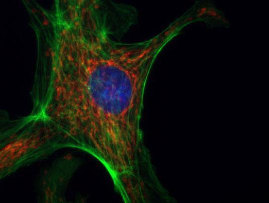 Applicazioni di ottica e fotonica L utilizzo di sostanze coloranti per marcare materiali biologici è alla base di quasi tutte le tecniche elencate.