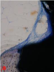 Nella zona midollare rimanente si nota un sottile strato di matrice ( in blu nella