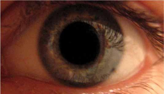 L occhio L occhio può modificare la quantità di luce che raggiunge la retina attraverso la pupilla.