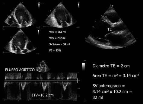 (Figure 3 e 4).