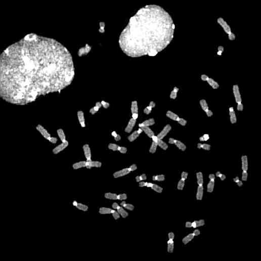 FISH: metafase in DAPI Cromosomi