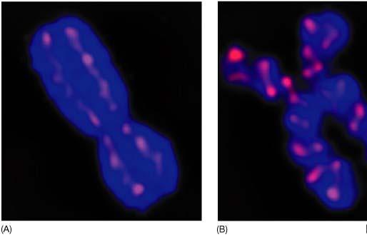 coesine condensine Da cosa dipende la condensazione della