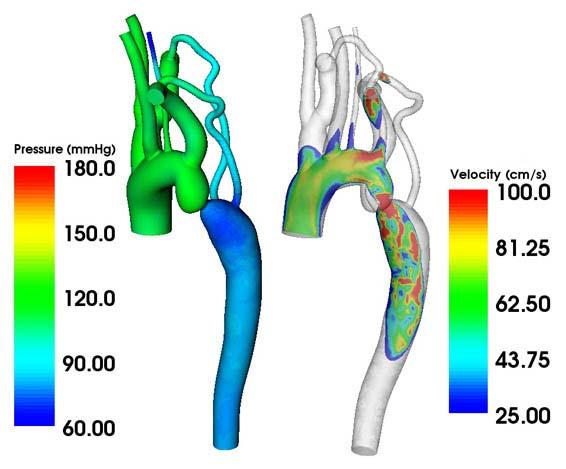 regolarmente chiuso. La compresenza di cardiopatie congenite associate accelera i tempi della presentazione clinica.