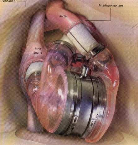 Equivalenti funzionali P2 Un cuore artificiale funziona perché è l equivalente funzionale di un cuore umano e non
