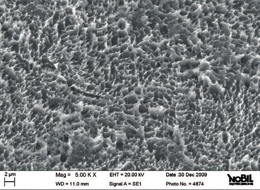 CYROTH IMPIANTI DENTALI Gli impianti dentali CYROTH e.i. di AoN sono viti endossee progettate e dimensionate per tutte le applicazioni nel settore della chirurgia odontoiatrica.