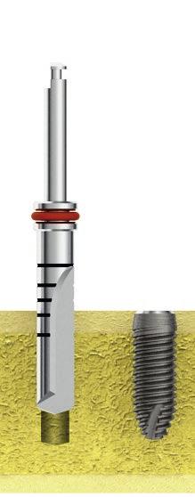 Sequenza di fresaggio CYROTH-EI Ø4,5 L. 13mm Utilizzare la fresa lanceolata per rompere la corticale e creare l invito necessario per le drill sucessive.