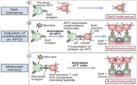 Malattie autoimmuni La malattia autoimmune è una condizione patologica in cui è avvenuta la rottura della tolleranza immunologica verso uno o più antigeni "self".