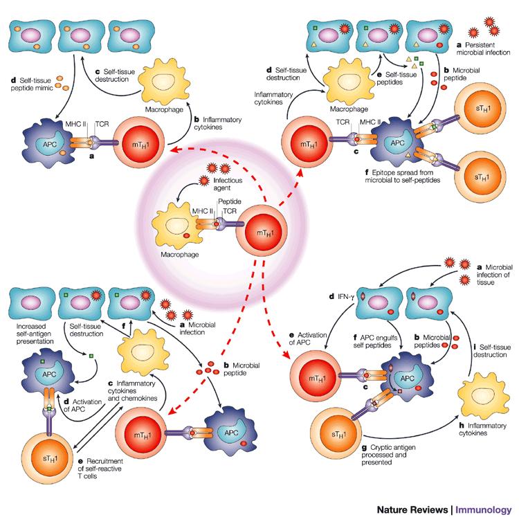 Ipotesi infettiva Molecular mimicry Epitope spreading Bystander