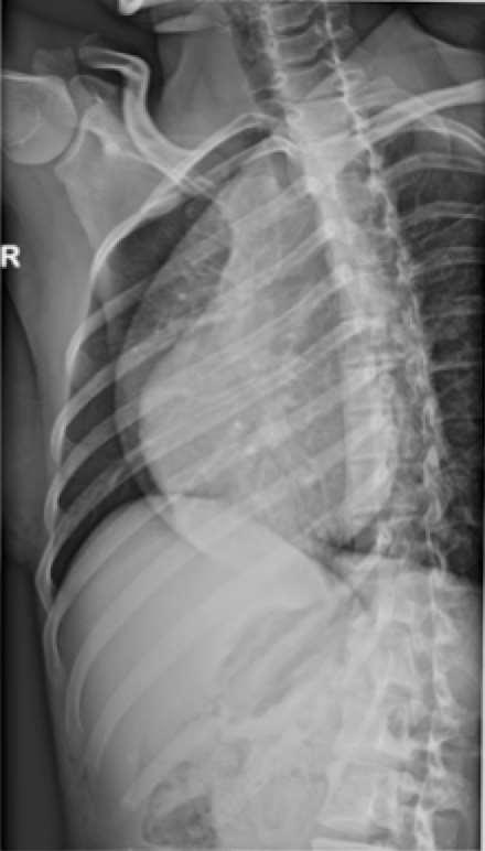 Coste: PROIEZIONE OBLIQUA Risultato radiografico Criteri correttezza Segmenti posteriori, anteriori ed archi