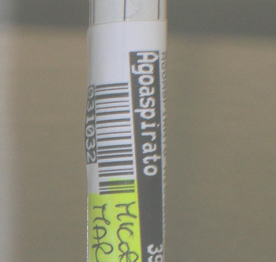 Cherian Consultant Microbiologist Whipps Cross Hospital, London BMJ 1996; 12: 27 Urine con coltura positiva per MTB Totale pazienti Sintomi d organod Pyuria ( (