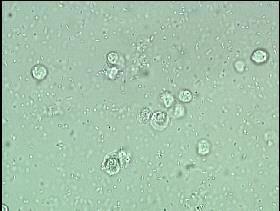 cellule epiteliali and rare