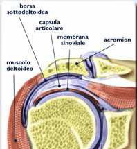Epicondilite: infiammazione dei tendini dei muscoli dell avambraccio, che si inseriscono sulla faccia laterale del gomito.