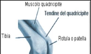 Borsite del ginocchio: infiammazione della borsa sierosa prepatellare collocata anteriormente e distalmente dalla rotula Sintomi: calore al