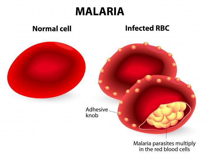 PAROSSISMO MALARICO Febbre terzana : il ciclo si ripete ogni 48 ore (Plasmodium vivax e Plasmodium ovalis, terzana benigna, incubazione 8-14 giorni; Plasmodium falciparum, terzana