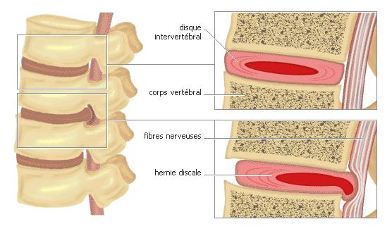Le articolazioni semimobili permettono movimenti limitati, ad es. tra le vertebre oppure tra le costole e lo sterno.