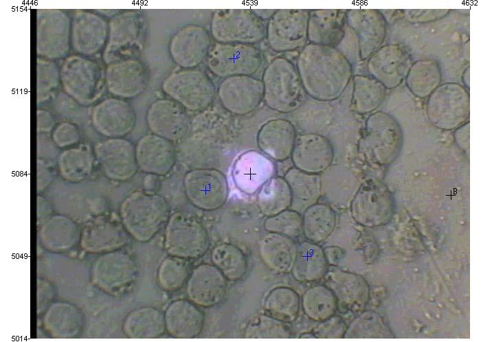 Fotografia dell immagine osservata attraverso un microscopio IR di una coltura di cellule cancerogene poste su