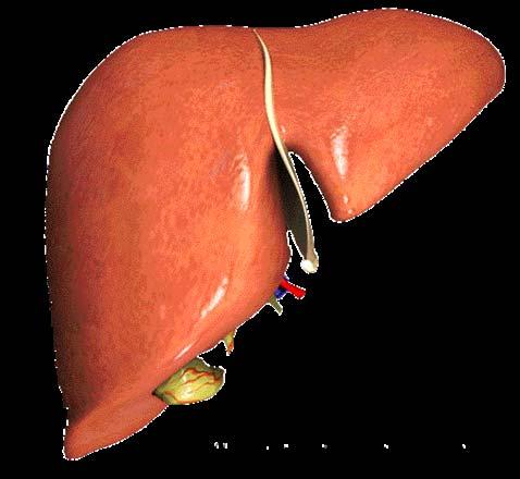 METABOLIC SYNDROME Insulin-resistence steatosis FFA TNFα FAT INSULIN RESISTANCE