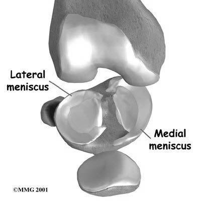 traumatiche degenerative Lesioni