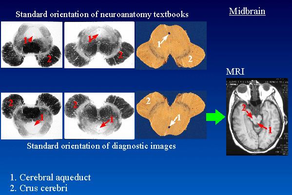 Orientamento standard presente sui libri di testo Mesencefalo Orientamento
