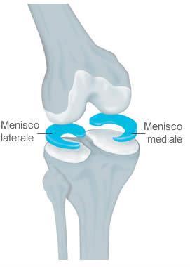 Il Menisco laterale ha una forma circolare, a ferro di cavallo, ed ha più mobilità.