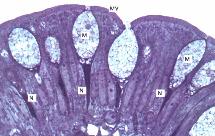 Varie classificazioni Isolate Epitelio esocrino di superfici secernenti Epitelio esocrino che forma il parenchima di ghiandole esocrine.